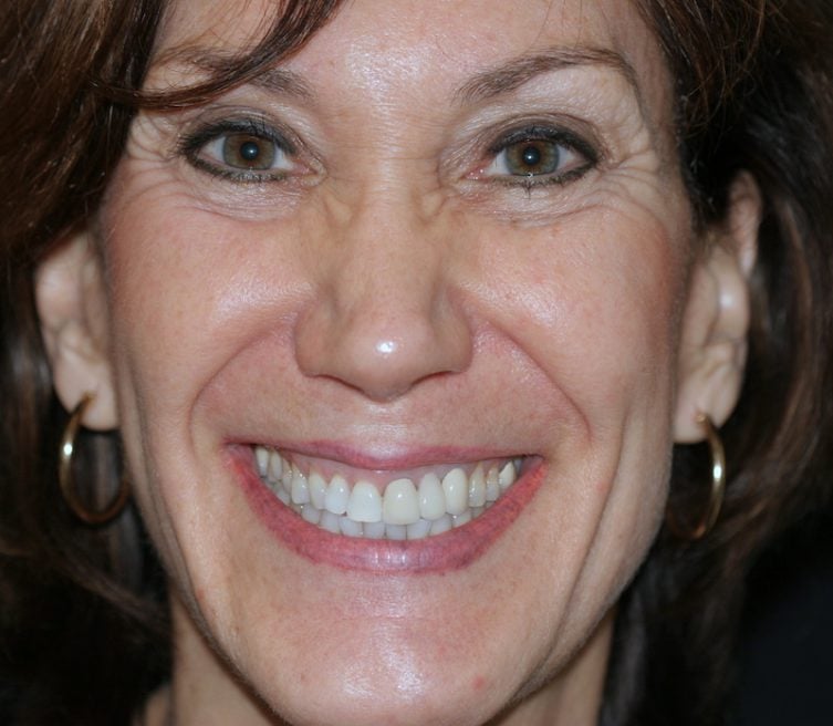 close up of woman in smile gallery