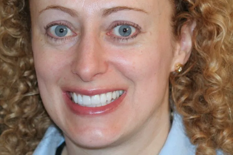 SVETLANA SMILE AFTER SMILE MAKEOVER WITH PORCELAIN VENEERS