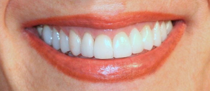 Close up Smile