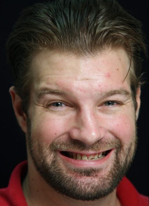 Man's Smile before dental treatment