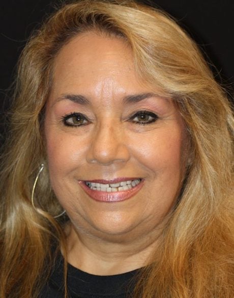 close up of woman in smile gallery