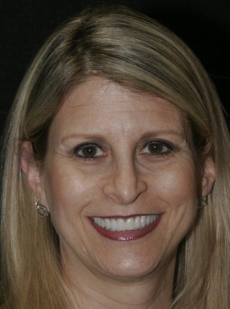 close up of woman in smile gallery