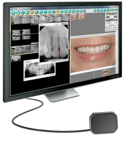 computer scene showing teeth images