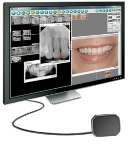 computer scene showing teeth images