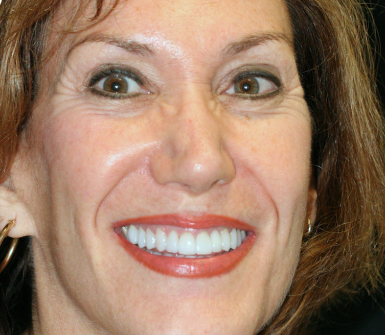 close up of woman in smile gallery