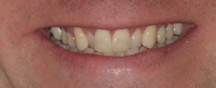 Before cosmetic dentistry