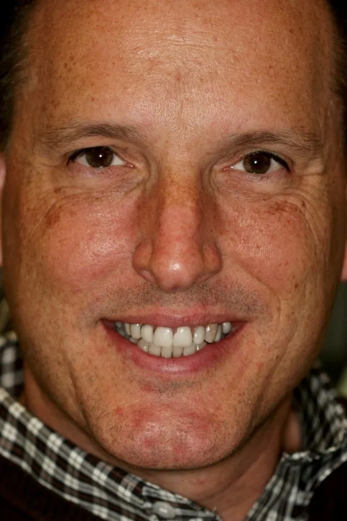 Image of patient from Bethesda Center for Family and Cosmetic Dentistry